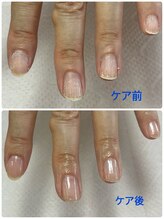 リアン(lien)/ハンドクイックケア