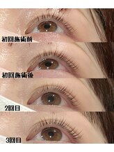 ジョワ(Joie)/マイラミネーション