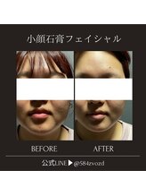 フィールグルック(Viel Gluck)/1回でも目に見える変化♪