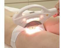 ハーレ(HA-RE)/人気VIO脱毛はお任せください！