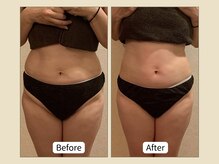 ミリュー(mylieu)/大人気プレミアムコース初回変化