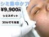 《シミ集中ケア改善コース》◆30分シミケアスポット照射 ¥16,500→¥9,900
