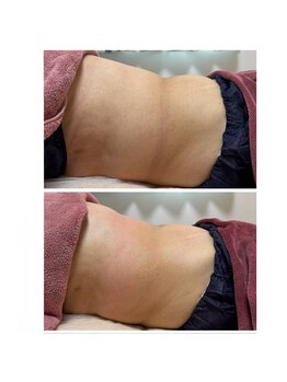 シュガー(Sugar...iyr)/スッキリボディーに！