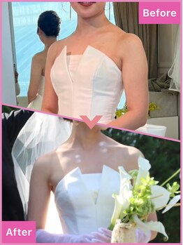 ポノ インディバ サロン(pono. Indiba salon)/デコルテ美人