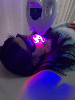 グリッター ショウナン(glitter. SHONAN)/お客様★ホワイトニング