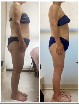 ペルラ(Perla)/お客様ビフォーアフター