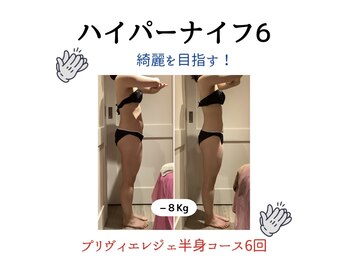 プリヴィエレジェ(privilegie)/