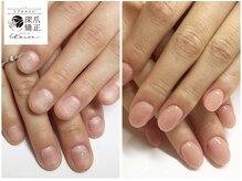 トイロ(toiro)/自爪「質」と「土台」を変えます