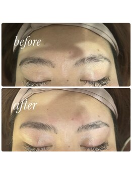 サロブリーユ(Carebrille)/ハリウッドブロウリフト