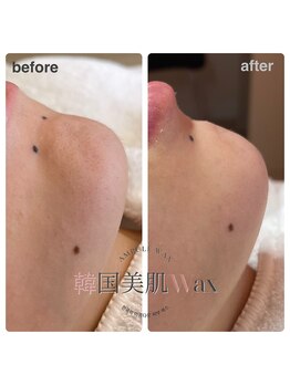 ティアム(Tiam)/韓国美肌wax