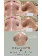 クレヴィー(Creviy)/韓国式3D毛穴洗浄×ハーブ(1回)