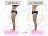 Rサイズ【脂肪冷却】下半身太りに！太もも or お尻下2ヶ所★25600→19600円