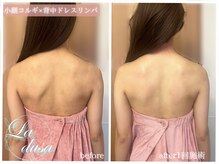 ラ ドゥーサ(La Dusa)/ブライダル前に必須ドレスリンパ