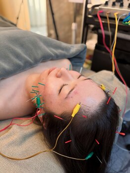 ルミア(LUMiA)の写真/【くすみ・たるみ・食いしばりを改善◎】凝り固まった表情筋をほぐして引き締め、理想のフェイスラインへ♪