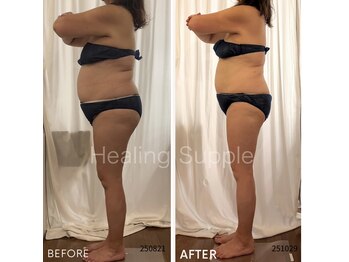 ヒーリングサプリ(Healing Supple)