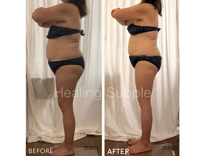 ヒーリングサプリ(Healing Supple)の写真