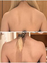 パルティール 恵比寿店(partir)/肩凝り解消で背中美人♪