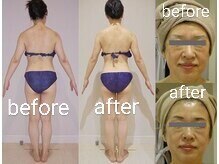 アルマ 芦屋(ALMA)