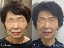 ひじ鍼灸整骨院/美容鍼Before /After◎