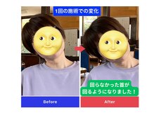 田中療術院 松江分院の雰囲気(ずっとあった首こりが軽くなった!と喜ばれました。)