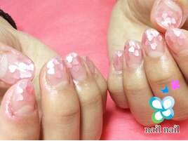 深爪→スカルプ(After)♪