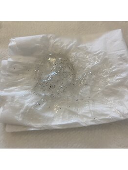 ビクト(Vict)/ヒゲ脱毛でポップアップ現象◎