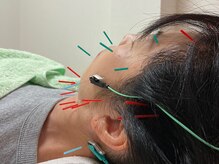 ばば鍼灸院/50代女性の方