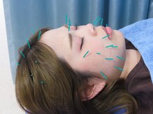 赤沼鍼灸整骨院/お顔の血流促進で美肌に！！！