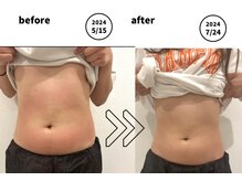 エンカフェサロン(en-cafe salon)/《2ヶ月でこの変化》