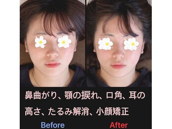 美容矯正サロン レレポノ(LELEPONO)/