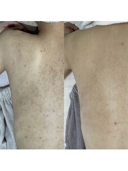 シェノン 赤坂大濠店/