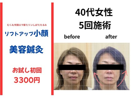 れんげ鍼灸整骨院の写真