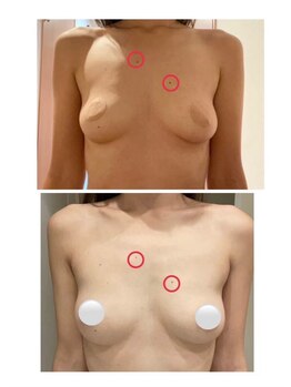 美人バスト 浦和店/【バストアップ★育乳】症例