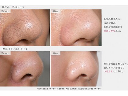 ポアラ(POARA)の写真