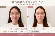 アミティ プラス(amity plus)