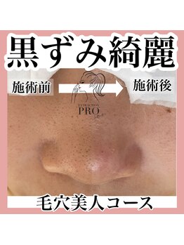 シェリー(Cherie)/80分後には劇的★Before→After