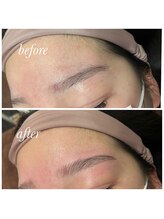 サロブリーユ(Carebrille)/ハリウッドブロウリフト