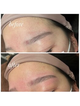 サロブリーユ(Carebrille)/ハリウッドブロウリフト