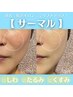【韓国サーマルリフト】顔～首/しわ/たるみ改善/肌悩み別パック付★15,400→