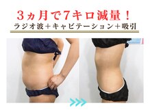 エスプラ 五反田店の雰囲気（お腹20分コース♪腰回りのお肉をプロのマシンで燃焼・分解！）