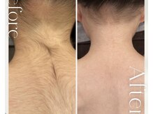 モアトゥインクル 福山神辺店(MORE twinkle)