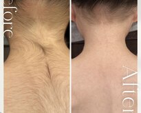 モアトゥインクル 福山神辺店(MORE twinkle)