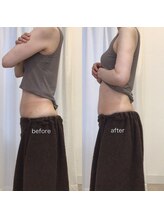 ジョワイユ(Joyeux)/腸の位置でお腹は変わる