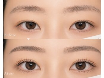 ラルア 名駅前店(RALUA)の写真/お客様のお悩みに寄り添うことを１番にカウンセリングを重視するコンプレックス解消のお手伝いサロン♪