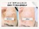 ル ボヌールの写真/ダウンタイムなし！シミケア特化型の最新光美容機器でシミなし、同時に複数の肌悩みを解消♪ボヤシミも◎