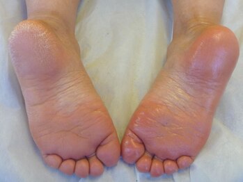 トータルビューティーサロン キララ(KIRARA)/◆FOOT角質ケア