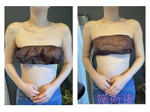 エスデザイン(es design)/ブライダルエステ／肩甲骨／首肩