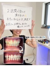 グロウ 東区香椎(GLOW)/当サロンに来られたお客様