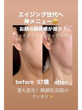 サロン ド プリヴェ(Salon de PRIVE)/神メニュー誕生！たるみケア特化