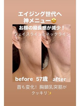 サロン ド プリヴェ(Salon de PRIVE)/神メニュー誕生!たるみケア特化